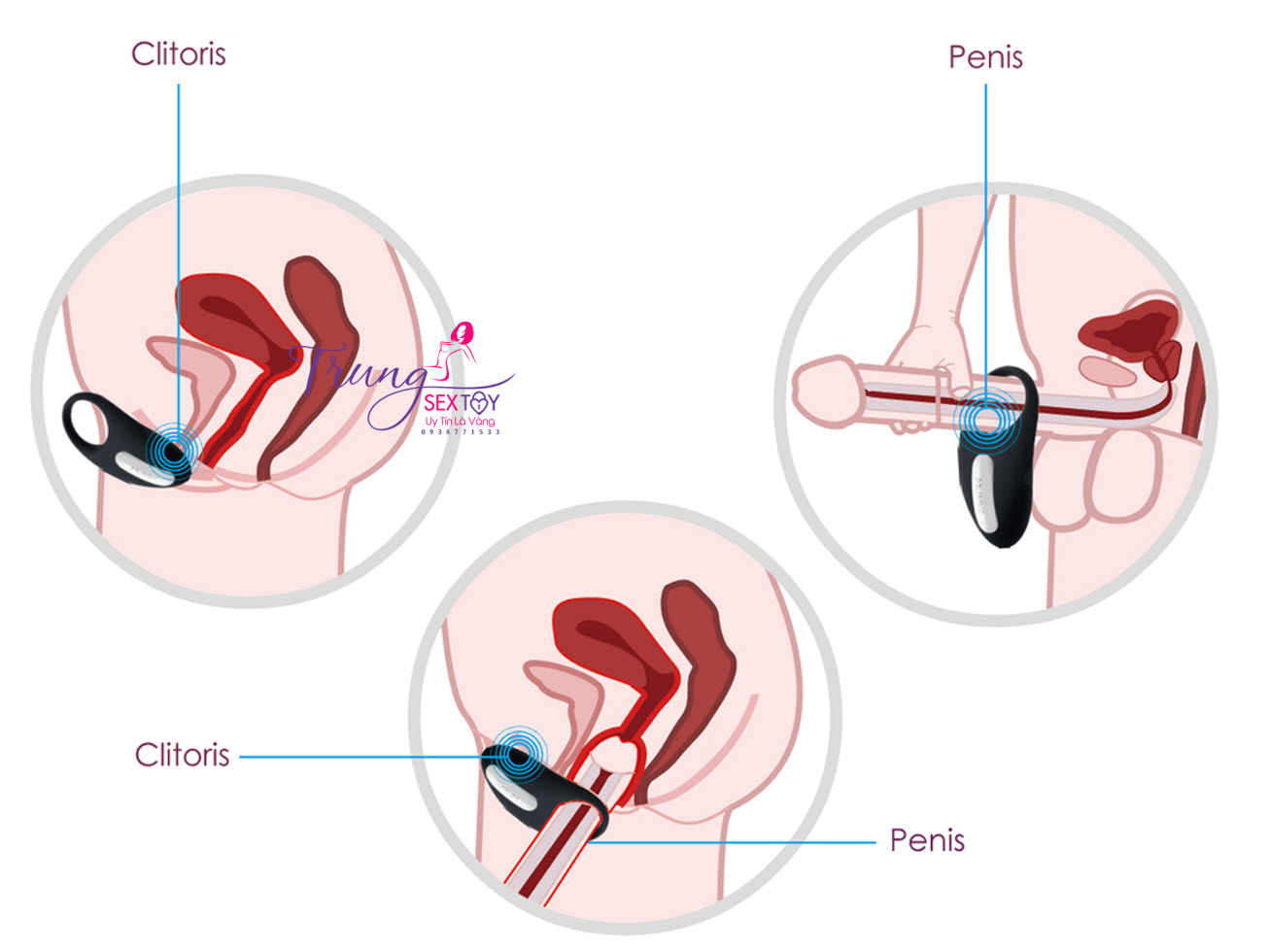 vòng đeo cu hãm tinh vòng đeo cu hãm tinh
