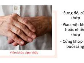 Biến chứng của viêm khớp dạng thấp . 