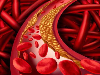 Cảnh báo - rối loạn lipid máu ở bệnh nhân tiểu đường