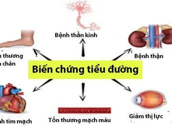 Những biến chứng khó lường của bệnh tiểu đường