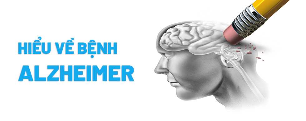 Bất ngờ khi được chẩn đoán mắc chứng Alzheimer