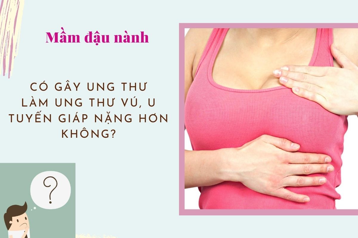 Viên uống SB an toàn cho phụ nữ u xơ hoặc cắt bỏ tử cung