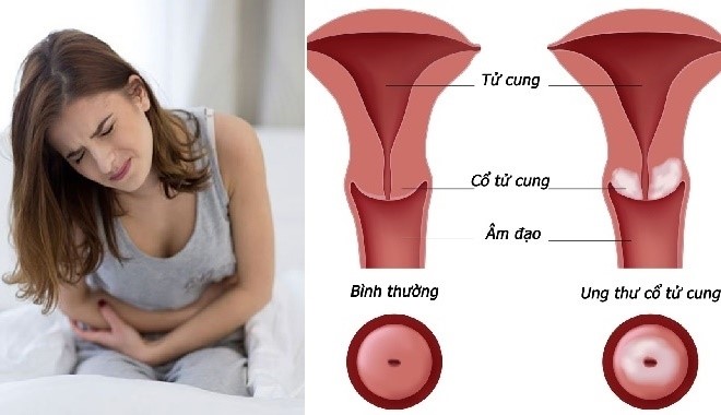 noi-tiet-to-phu-nu-1