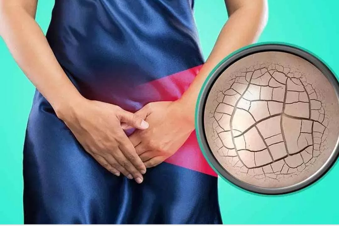 8 cách khắc phục tình trạng khô hạn chị em không thể bỏ qua