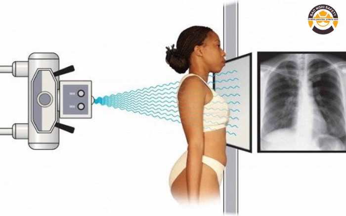 Tia X là gì và tại sao cần được chắn lại