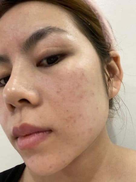 Kem Face Retinol MQ Skin 0.5% - ƯU ĐÃI HẤP DẪN
