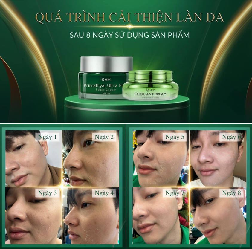 Chăm sóc da sau khi dùng tái tạo da nội sinh mq skin