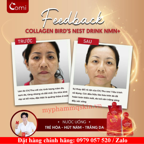 Collagen comi yến nmn bao nhiêu tuổi uống được Collagen comi yến nmn bao nhiêu tuổi uống được