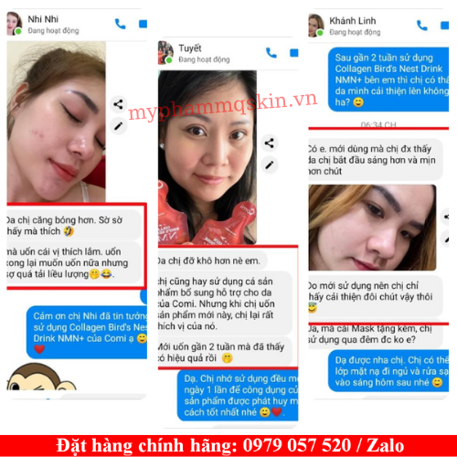 Collagen comi yến nmn có tốt không Collagen comi yến nmn có tốt không