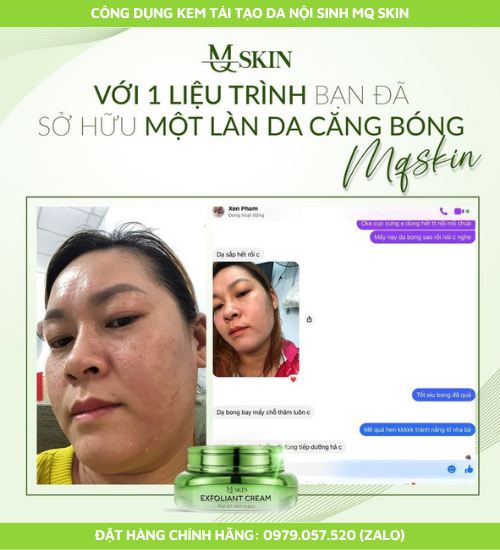 Da khách dùng kem tái tạo da nội sinh mq skin Da khách dùng kem tái tạo da nội sinh mq skin
