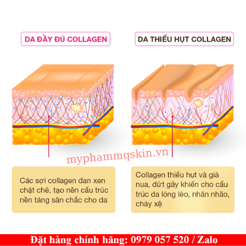 Dấu hiệu thiếu hụt collagen Dấu hiệu thiếu hụt collagen