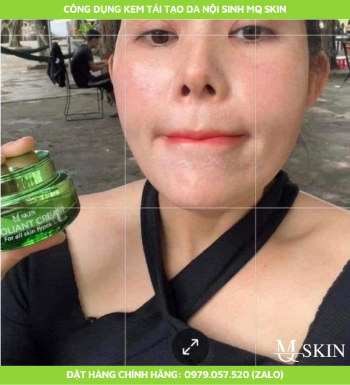 Hướng dẫn sử dụng kem tái tạo da nội sinh mq skin Hướng dẫn sử dụng kem tái tạo da nội sinh mq skin