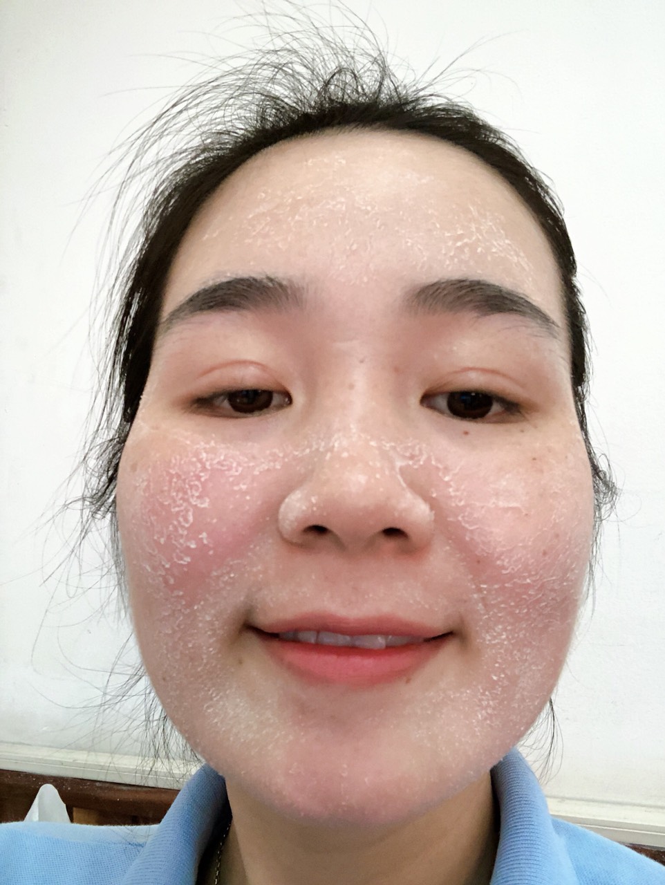Hướng dẫn dùng serum thay da không sưng mqskin Hướng dẫn dùng serum thay da không sưng mqskin