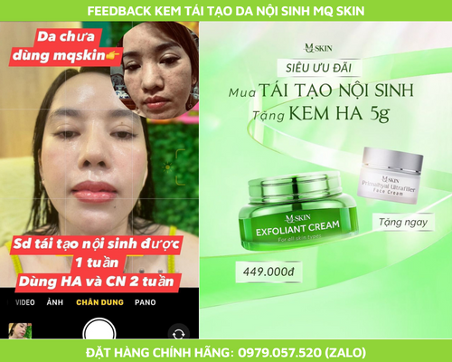 Thành phần tái tạo nôi sinh mq skin Thành phần tái tạo nôi sinh mq skin