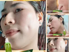 CÔNG DỤNG SERUM THAY DA NHÂN SÂM KHÔNG SƯNG MQSKIN | Mua 1 tặng 1 + miễn phí ship.