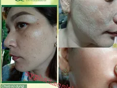 Serum Tái Tạo Da Nhân Sâm MQskin | Ưu đãi mua 1 tặng 1 + Miễn phí giao hàng.
