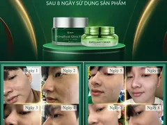 Chăm sóc da sau khi dùng tái tạo da nội sinh mq skin