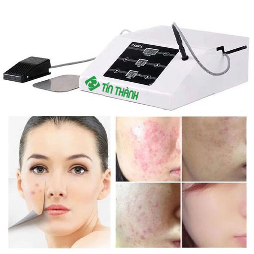 Tuyến bã nhờn là gì và làm thế nào để loại bỏ? Tuyến bã nhờn là gì và làm thế nào để loại bỏ?