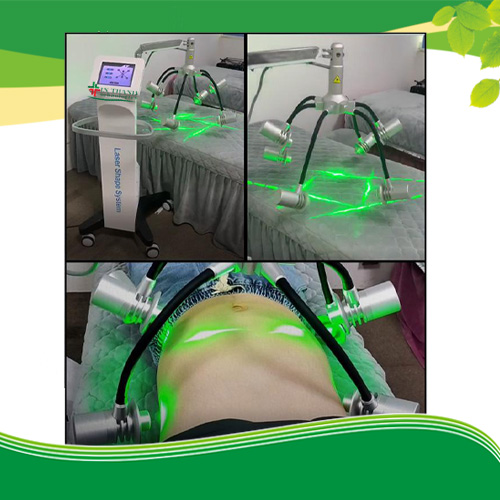 Máy giảm béo laser Zerona 6D có hiệu quả không? Máy giảm béo laser Zerona 6D có hiệu quả không?