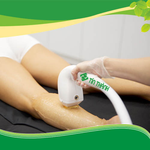 Mua máy triệt lông vĩnh viễn ở đâu tốt và rẻ ? Mua máy triệt lông vĩnh viễn ở đâu tốt và rẻ ?