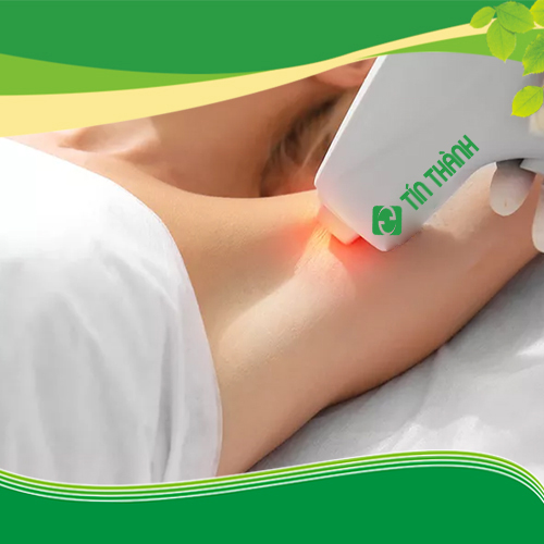 Triệt lông xung dài có hiệu quả không ? Triệt lông xung dài có hiệu quả không ?