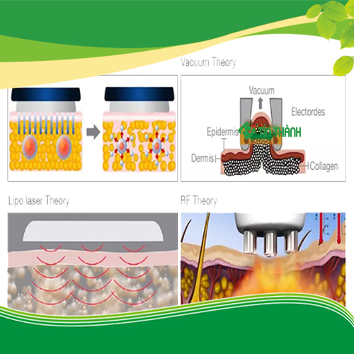 Máy giảm béo LS650 giá bao nhiêu và những điều cần biết Máy giảm béo LS650 giá bao nhiêu và những điều cần biết