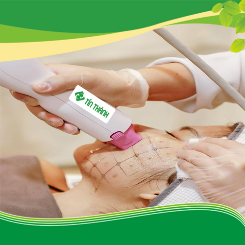 Liệu trình Thermage có hiệu quả không và diễn ra như thế nào? Liệu trình Thermage có hiệu quả không và diễn ra như thế nào?