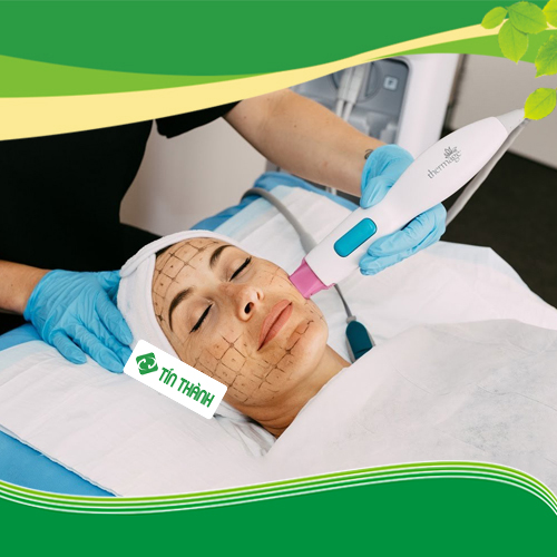 Liệu trình Thermage có hiệu quả không và diễn ra như thế nào? Liệu trình Thermage có hiệu quả không và diễn ra như thế nào?