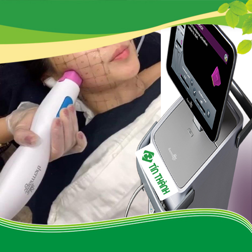 Tác dụng của Thermage Tác dụng của Thermage