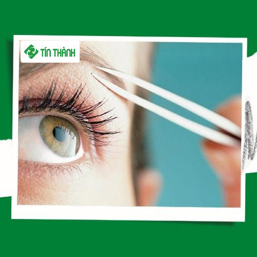 Biện pháp triệt lông mày vĩnh viễn và hiệu quả nhất hiện nay Biện pháp triệt lông mày vĩnh viễn và hiệu quả nhất hiện nay