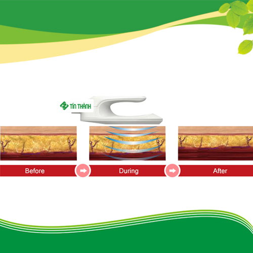 Máy tăng cơ giảm béo EMSCULPT giá bao nhiêu? Máy tăng cơ giảm béo EMSCULPT giá bao nhiêu?