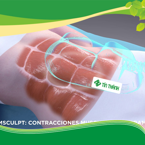 Review máy giảm mỡ bụng Emsculpt Review máy giảm mỡ bụng Emsculpt