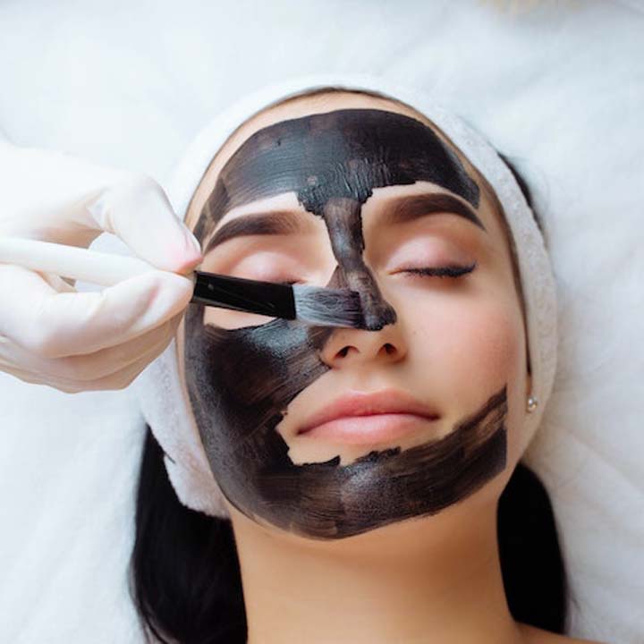 Bắn laser carbon than hoạt tính trị mụn như thế nào ? Bắn laser carbon than hoạt tính trị mụn như thế nào ?