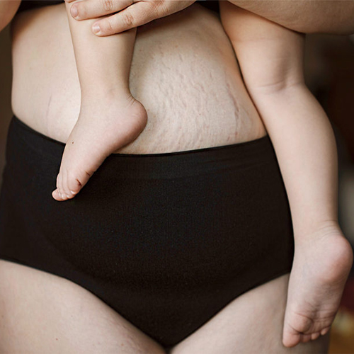 Bí quyết giảm mỡ bụng sau sinh hiệu quả Bí quyết giảm mỡ bụng sau sinh hiệu quả