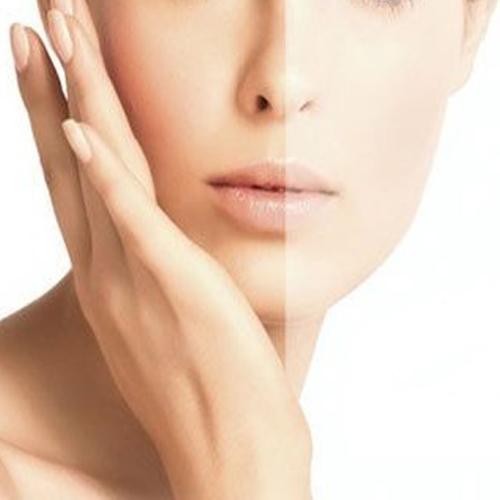 Cách dưỡng trắng da mùa hè Cách dưỡng trắng da mùa hè