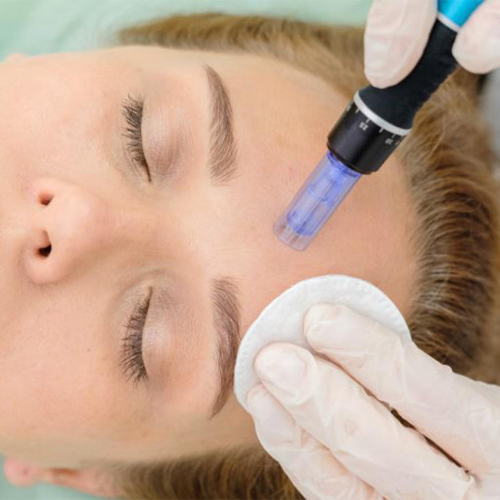 Cách sử dụng Máy lăn kim Dr Pen Cách sử dụng Máy lăn kim Dr Pen