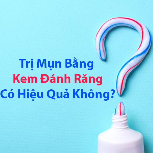 Cách trị mụn bằng kem đánh răng có hiệu quả không ? Cách trị mụn bằng kem đánh răng có hiệu quả không ?