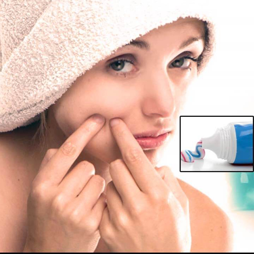 Cách trị mụn bằng kem đánh răng có hiệu quả không ? Cách trị mụn bằng kem đánh răng có hiệu quả không ?