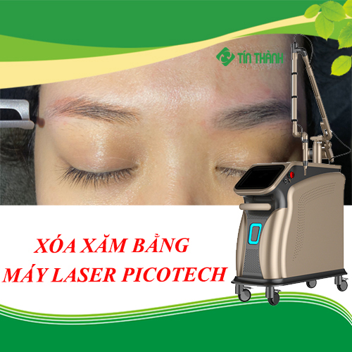Hướng dẫn cách chăm sóc da sau khi xóa xăm bằng laser Hướng dẫn cách chăm sóc da sau khi xóa xăm bằng laser