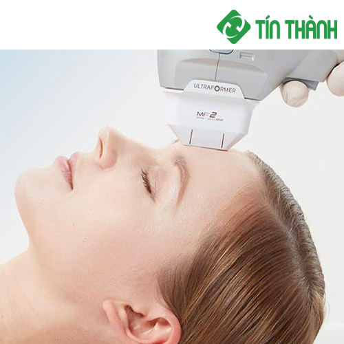 Công nghệ nâng cơ mặt Hifu có tốt không Công nghệ nâng cơ mặt Hifu có tốt không