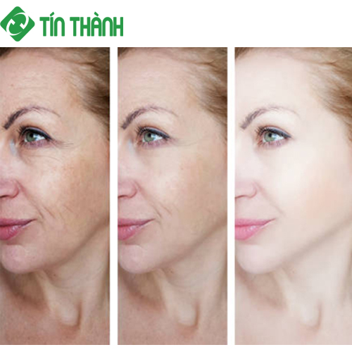 7 mẹo đơn giản nhưng hiệu quả để ngăn ngừa da mặt chảy xệ 7 mẹo đơn giản nhưng hiệu quả để ngăn ngừa da mặt chảy xệ