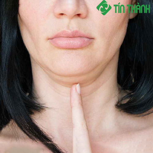 7 mẹo đơn giản nhưng hiệu quả để ngăn ngừa da mặt chảy xệ 7 mẹo đơn giản nhưng hiệu quả để ngăn ngừa da mặt chảy xệ