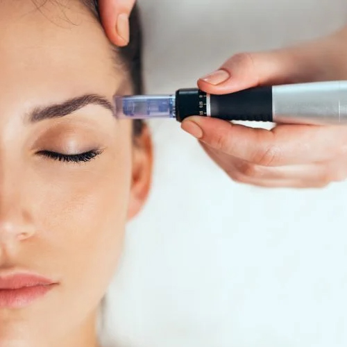 Dụng cụ lăn kim trị mụn có tốt không? Dụng cụ lăn kim trị mụn có tốt không?