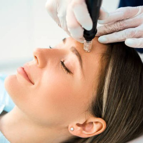 Hướng dẫn kỹ thuật lăn kim tại nhà an toàn Hướng dẫn kỹ thuật lăn kim tại nhà an toàn