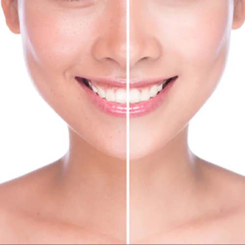 Làm sao để trắng da nhanh và hiệu quả Làm sao để trắng da nhanh và hiệu quả