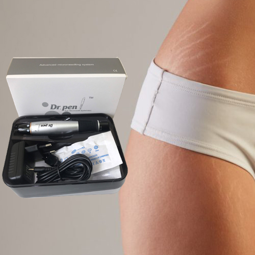 Lăn kim trị rạn da bằng Máy lăn kim Dr Pen Lăn kim trị rạn da bằng Máy lăn kim Dr Pen