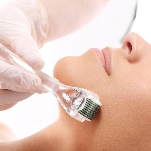 Những điều cần biết về công nghệ lăn kim trị sẹo Những điều cần biết về công nghệ lăn kim trị sẹo