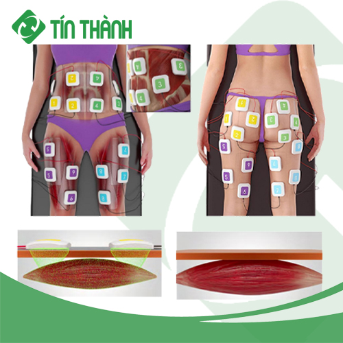 Các vùng điều trị của Máy giảm béo tăng cơ Sculpting EMS Các vùng điều trị của Máy giảm béo tăng cơ Sculpting EMS