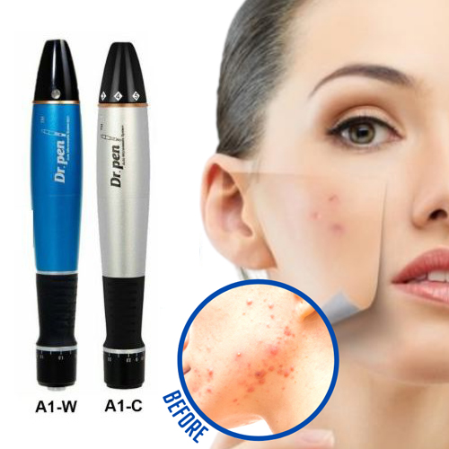 Trị sẹo mụn bằng Máy lăn kim Dr Pen A1 Trị sẹo mụn bằng Máy lăn kim Dr Pen A1