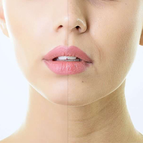 Phi kim tế bào gốc là gì và những lợi ích Phi kim tế bào gốc là gì và những lợi ích